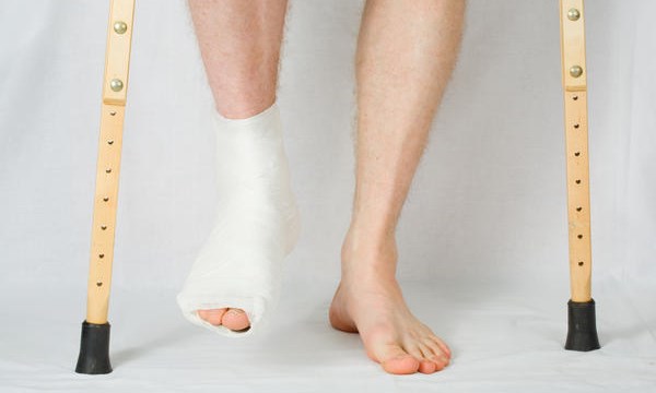 Vật lý trị liệu cho bệnh nhân sau gãy chân